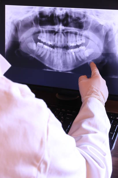 Best Emergency Treatment for Dental Infections or Abscesses in Batavia, OH